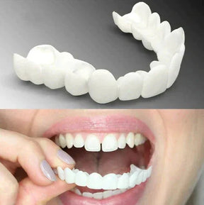 Facetas Odontológicas Removíveis